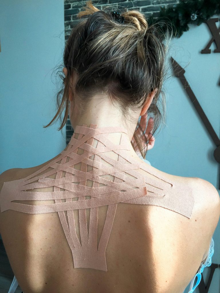 „Frau mit Kinesio-Tape auf dem oberen Rücken und Nacken, Behandlung bei Verspannungen und Schmerzen durch physiotherapeutisches Taping.“