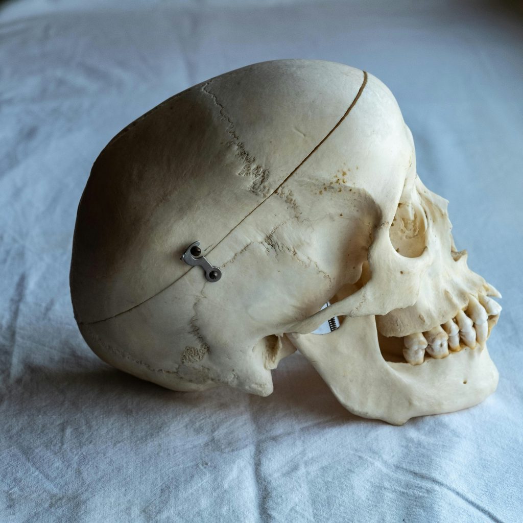 Seitliche Ansicht eines menschlichen Schädelmodells mit sichtbaren Knochenstrukturen und Metallverbindungen auf weißem Tuch.